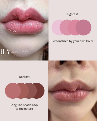 Lilla Gorgeous  image_picker_241E3ECE-B2B0-4587-90F6-4E5408EE4956-21096-00000768289D0C0C
