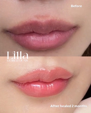 Lilla Gorgeous  image_picker_19DC053B-5DCD-4EEC-BF38-61C81FA565DB-21096-000007682966DC8A