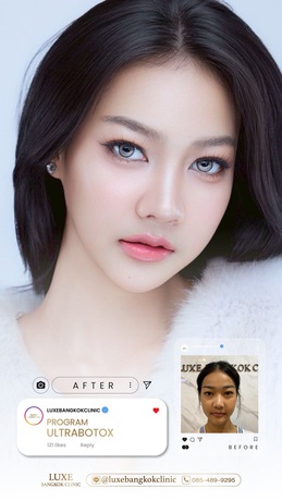 Luxe Bangkok Clinic (BTS Phahonyothin 24) Luxe Bangkok Clinic (BTS Phahonyothin 24) (มีสาขาเดียวเท่านั้น)  image_picker_74F46632-E2E5-407E-8939-B6227C1B788E-94420-00000C5AEF7F3463