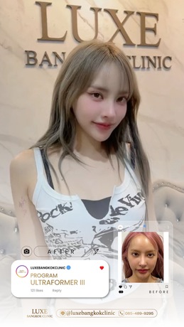 Luxe Bangkok Clinic (BTS Phahonyothin 24) Luxe Bangkok Clinic (BTS Phahonyothin 24) (มีสาขาเดียวเท่านั้น)  image_picker_5BE91300-4751-4398-88EF-9F2C41B7B314-94420-00000C5AEF8D1FD8