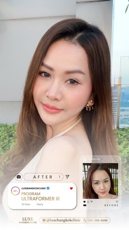 Luxe Bangkok Clinic (BTS Phahonyothin 24) Luxe Bangkok Clinic (BTS Phahonyothin 24) (มีสาขาเดียวเท่านั้น)  image_picker_99CEFEDD-8BC9-4CFE-9100-6FF31940EF41-94420-00000C5AEF281688