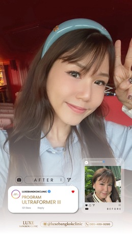 Luxe Bangkok Clinic (BTS Phahonyothin 24) Luxe Bangkok Clinic (BTS Phahonyothin 24) (มีสาขาเดียวเท่านั้น)  image_picker_11BB795D-CFB7-4970-BAF5-A4B1455EE9C3-94420-00000C5AEFAF954D
