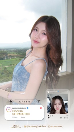 Luxe Bangkok Clinic (BTS Phahonyothin 24) Luxe Bangkok Clinic (BTS Phahonyothin 24) (มีสาขาเดียวเท่านั้น)  image_picker_3FB08D3E-2B1D-499E-8394-210E7105B4B2-94420-00000C5AEF3629C5