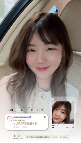 Luxe Bangkok Clinic (BTS Phahonyothin 24) Luxe Bangkok Clinic (BTS Phahonyothin 24) (มีสาขาเดียวเท่านั้น)  image_picker_96DA2473-2F5A-4ADF-A6F9-59FAFEDBFDC0-94420-00000C5AEF444858