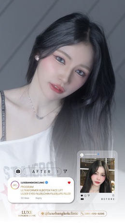 Luxe Bangkok Clinic (BTS Phahonyothin 24) Luxe Bangkok Clinic (BTS Phahonyothin 24) (มีสาขาเดียวเท่านั้น)  image_picker_E67304FF-EB69-4A1F-8C99-B63DE5CE49C9-94420-00000C5AEF515CC7