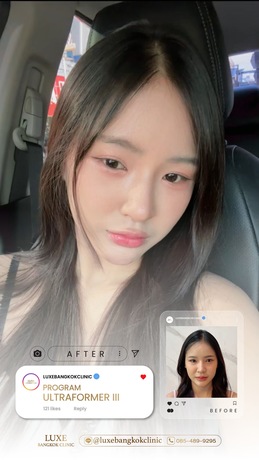 Luxe Bangkok Clinic (BTS Phahonyothin 24) Luxe Bangkok Clinic (BTS Phahonyothin 24) (มีสาขาเดียวเท่านั้น)  image_picker_B472EA1E-9EC0-43D5-8D87-5AFEFE7A140E-94420-00000C5AEF5F64F0