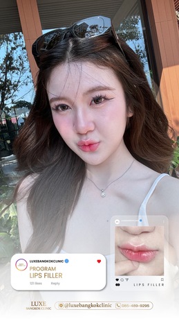 Luxe Bangkok Clinic (BTS Phahonyothin 24) Luxe Bangkok Clinic (BTS Phahonyothin 24) (มีสาขาเดียวเท่านั้น)  image_picker_2FAF8C1D-2AAD-44D5-9482-6AABD551966D-94420-00000C5AEFA10181