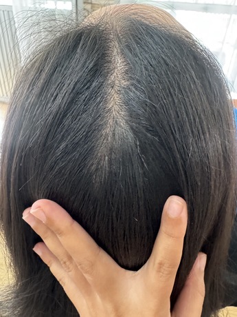 Service for Plucking Gray Hair Plucking Gray Hair Service - รับถอนผมหงอก พระราม 3 ซอยเฉลิมนิมิต 10 image_picker_05804988-EB61-4BFC-A1F4-60D92A195826-18576-000004A3CEEA19DB
