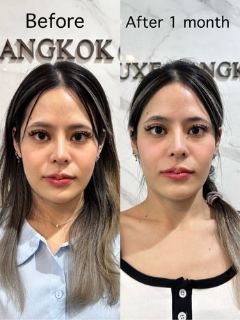 Luxe Bangkok Clinic (BTS Phahonyothin 24) Luxe Bangkok Clinic (BTS Phahonyothin 24) (มีสาขาเดียวเท่านั้น)  image_picker_C2791512-B2BB-4A1F-941C-F3DA5D804E51-22465-000002A2E8991588