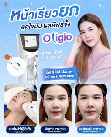 STELLAR CLINIC  image_picker_6E29E8DB-81AA-4623-97B7-BBB44D5FCB6A-2312-000000957F9B76C9