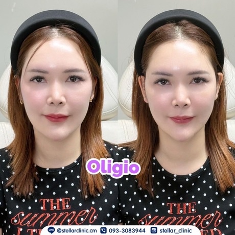 STELLAR CLINIC  image_picker_0066867C-D395-4AD7-AC46-8EEE610AD014-2312-000000957FA7A3B3