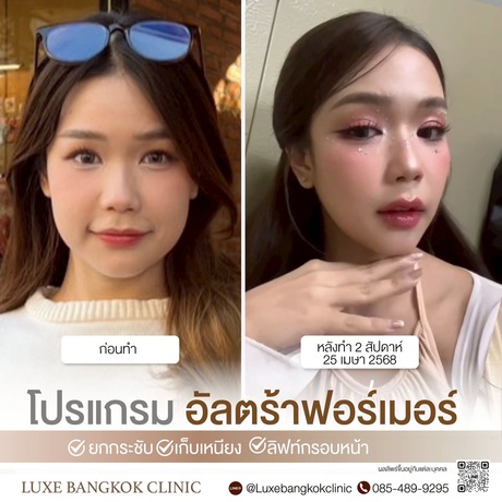 Luxe Bangkok Clinic (BTS Phahonyothin 24) Luxe Bangkok Clinic (BTS Phahonyothin 24) (มีสาขาเดียวเท่านั้น)  image_picker_7821CBF3-B92B-42B9-BE3F-D5C8C1188263-67356-00000813FED44EC4