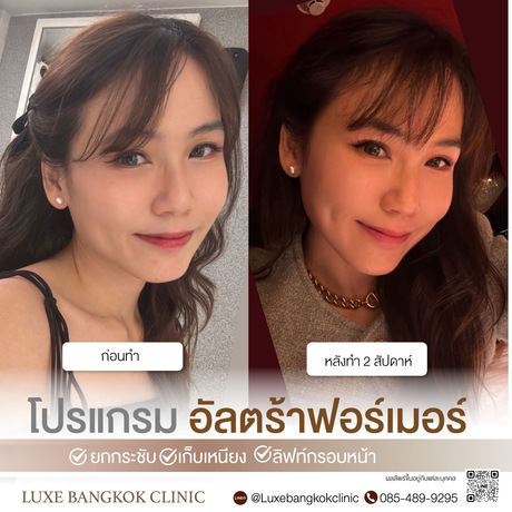Luxe Bangkok Clinic (BTS Phahonyothin 24) Luxe Bangkok Clinic (BTS Phahonyothin 24) (มีสาขาเดียวเท่านั้น)  image_picker_56FACB92-7FD0-4661-8457-BDCDB9FD22F9-67356-00000813FF05DCEC