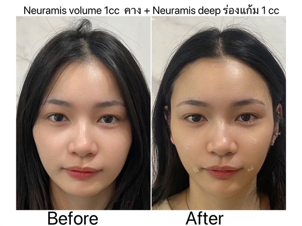 Luxe Bangkok Clinic (BTS Phahonyothin 24) Luxe Bangkok Clinic (BTS Phahonyothin 24) (มีสาขาเดียวเท่านั้น)  image_picker_E15CCB08-5187-48D8-A847-41241B904357-67356-00000814E5D683A2