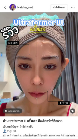 Luxe Bangkok Clinic (BTS Phahonyothin 24) Luxe Bangkok Clinic (BTS Phahonyothin 24) (มีสาขาเดียวเท่านั้น)  image_picker_18A8A6BB-D090-42C6-88E0-A2B39538D54A-67356-00000814E7B260F0