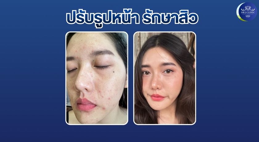 Dr.J Clinic (Rama 3) Dr.J clinic Rama3  6