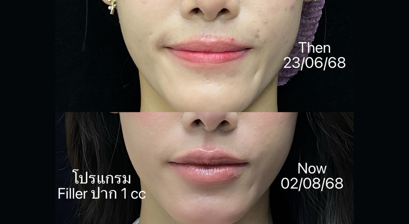 Dr.Ploi Clinic Bangsaen Dr.Ploi Clinic Bangsaen - คลินิกหมอพลอย บริการความงามครบวงจร ย่านบางแสน 3