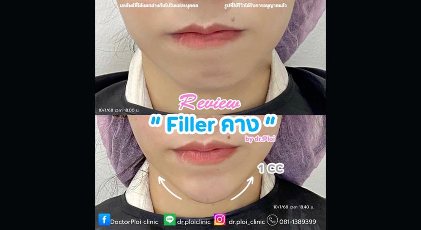 Dr.Ploi Clinic Bangsaen Dr.Ploi Clinic Bangsaen - คลินิกหมอพลอย บริการความงามครบวงจร ย่านบางแสน 2