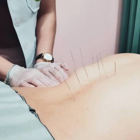 PSB Acupuncture Clinic  BHH4WnooeGtu8OFBfUQSjrKMVx2LEKpAjOF2q4g2XQKWArXWHUgVMv_1xf3QUBeTspPfldb2cbiXvNC6gfaL4Gq4ltAmHD-VNLJRyeyfSvHfmyKYt_a4U0vPE8fMXtxYQ0mGTKiMiK02azDH-NEk1Q__