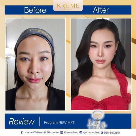 Kreme Clinic Kreme Clinic - ครีมคลินิก บริการเสริมความงามครบวงจร ย่านสุขุมวิท 2