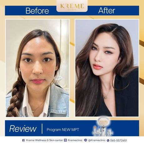 Kreme Clinic Kreme Clinic - ครีมคลินิก บริการเสริมความงามครบวงจร ย่านสุขุมวิท 4