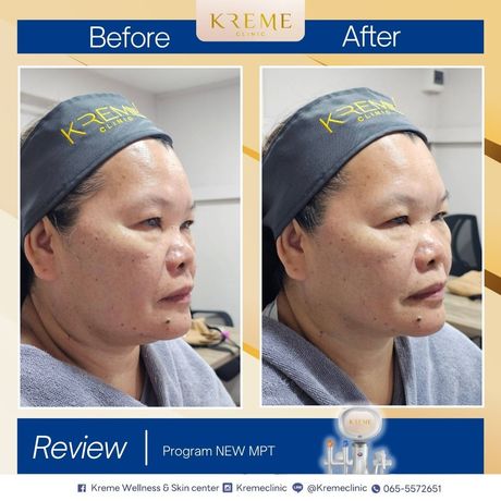 Kreme Clinic Kreme Clinic - ครีมคลินิก บริการเสริมความงามครบวงจร ย่านสุขุมวิท 9
