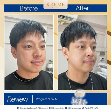 Kreme Clinic Kreme Clinic - ครีมคลินิก บริการเสริมความงามครบวงจร ย่านสุขุมวิท 35