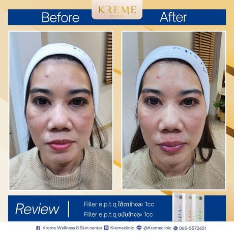 Kreme Clinic Kreme Clinic - ครีมคลินิก บริการเสริมความงามครบวงจร ย่านสุขุมวิท 38
