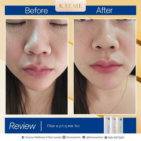 Kreme Clinic Kreme Clinic - ครีมคลินิก บริการเสริมความงามครบวงจร ย่านสุขุมวิท 42