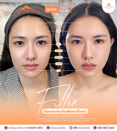 Arcturus Clinic Arcturus Clinic - อาร์คทูรัส คลินิก บริการความงามครบวงจร ย่านพัฒนาการ image_picker_4EDF7C9B-5753-4DBA-BF4A-87106C8A7244-16095-000004CFF3DB6086