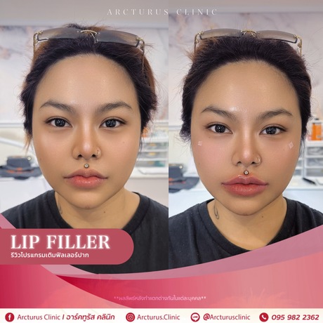 Arcturus Clinic Arcturus Clinic - อาร์คทูรัส คลินิก บริการความงามครบวงจร ย่านพัฒนาการ image_picker_5977243C-1E8F-4106-9B4B-2C393F62ED39-16095-000004CFF2BB9FF5