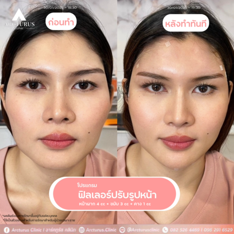 Arcturus Clinic Arcturus Clinic - อาร์คทูรัส คลินิก บริการความงามครบวงจร ย่านพัฒนาการ image_picker_E78662BA-7928-491B-855A-319E37A855A7-16095-000004D0E4800195