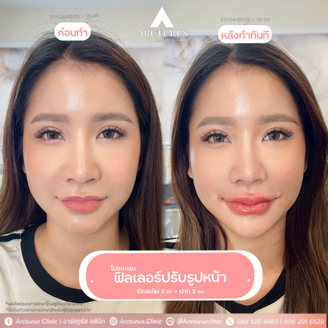 Arcturus Clinic Arcturus Clinic - อาร์คทูรัส คลินิก บริการความงามครบวงจร ย่านพัฒนาการ image_picker_6820404C-BF02-4A4E-AE12-B52253A0BE02-16095-000004D0E442DC22
