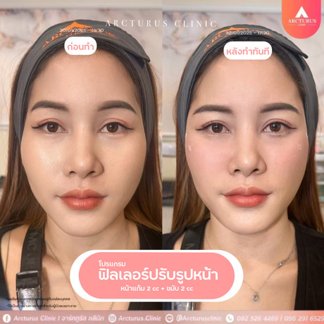 Arcturus Clinic Arcturus Clinic - อาร์คทูรัส คลินิก บริการความงามครบวงจร ย่านพัฒนาการ image_picker_F2375388-D32E-4916-9E25-CC2FAECCFC12-16095-000004D0E021C30D
