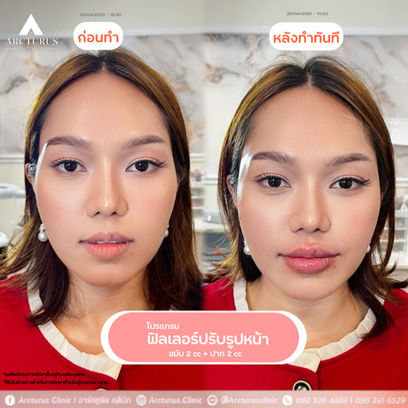 Arcturus Clinic Arcturus Clinic - อาร์คทูรัส คลินิก บริการความงามครบวงจร ย่านพัฒนาการ image_picker_100A39C6-C251-4D80-BBA0-22DF1AA9DA56-16095-000004D0E6F9BBEF