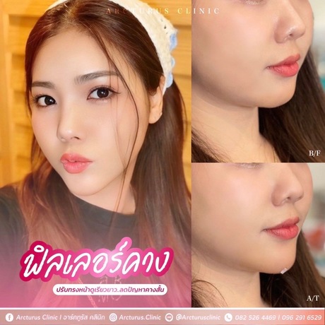 Arcturus Clinic Arcturus Clinic - อาร์คทูรัส คลินิก บริการความงามครบวงจร ย่านพัฒนาการ image_picker_4F0249AA-D8BF-4E7E-8A65-37C82B9B0A03-16095-000004D39CF3C27F