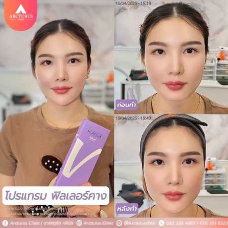 Arcturus Clinic Arcturus Clinic - อาร์คทูรัส คลินิก บริการความงามครบวงจร ย่านพัฒนาการ image_picker_E7163672-9520-4147-977B-608205838741-16095-000004D39BC44C98