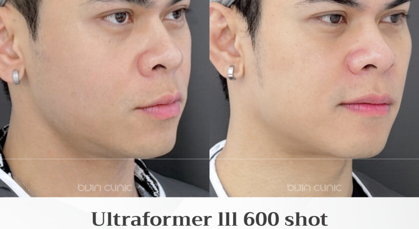 Bijin Clinic (BTS Wongwian Yai) Bijin Clinic (BTS Wongwian Yai) - บีจิน คลินิก ความงามครบวงจร ย่านวงเวียนใหญ่ 1