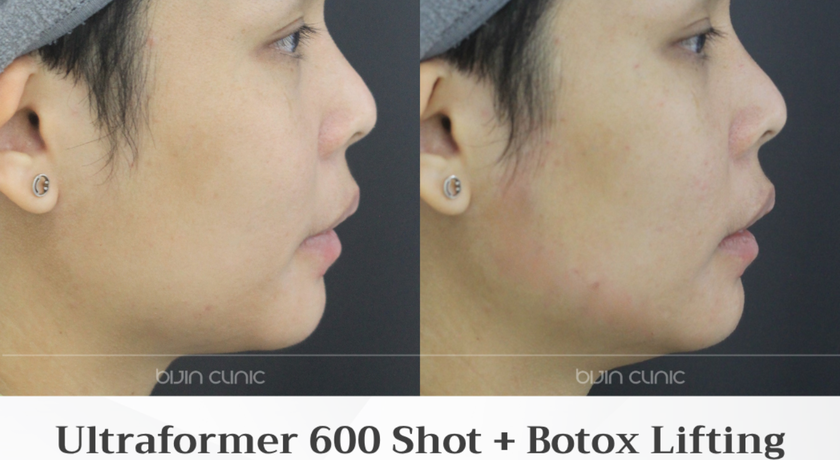 Bijin Clinic (BTS Wongwian Yai) Bijin Clinic (BTS Wongwian Yai) - บีจิน คลินิก ความงามครบวงจร ย่านวงเวียนใหญ่ 2