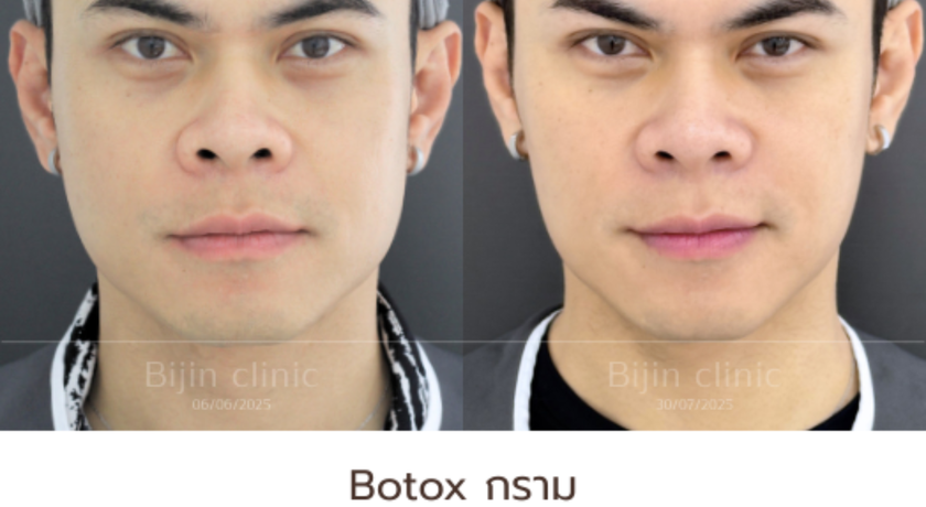 Bijin Clinic (BTS Wongwian Yai) Bijin Clinic (BTS Wongwian Yai) - บีจิน คลินิก ความงามครบวงจร ย่านวงเวียนใหญ่ 3