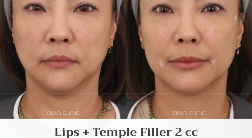 Bijin Clinic (BTS Wongwian Yai) Bijin Clinic (BTS Wongwian Yai) - บีจิน คลินิก ความงามครบวงจร ย่านวงเวียนใหญ่ 4