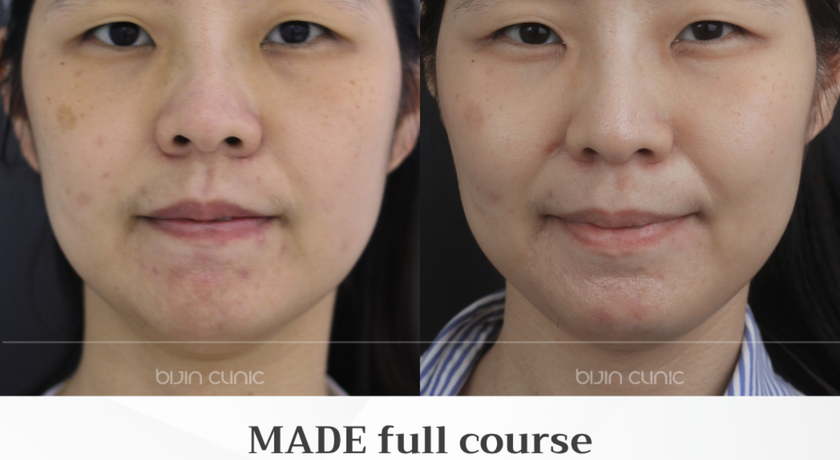 Bijin Clinic (BTS Wongwian Yai) Bijin Clinic (BTS Wongwian Yai) - บีจิน คลินิก ความงามครบวงจร ย่านวงเวียนใหญ่ 5