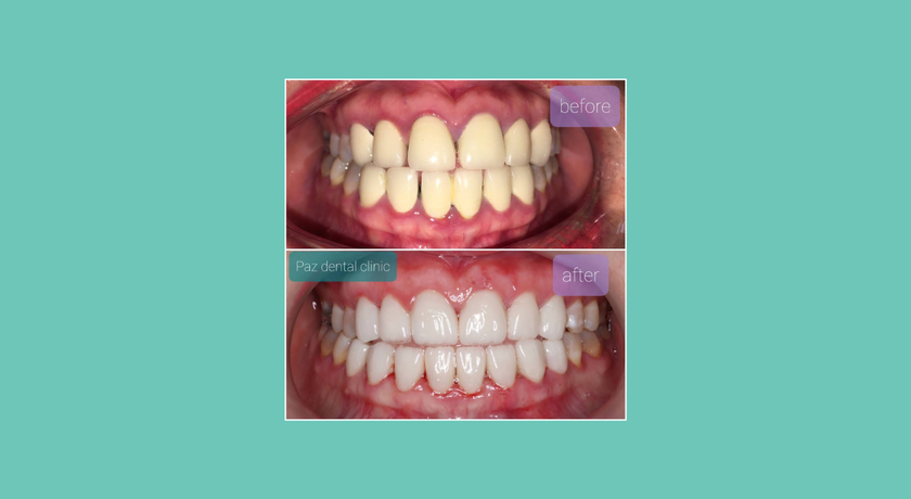 Paz Dental Clinic Paz Dental Clinic – พาซ เดนทัล คลีนิค ทำฟัน พาราไดซ์ พาร์ค 6