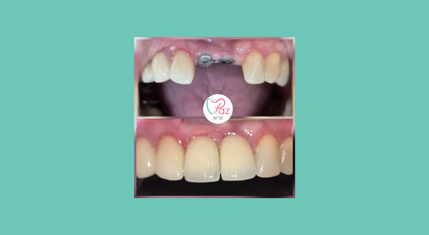 Paz Dental Clinic Paz Dental Clinic – พาซ เดนทัล คลีนิค ทำฟัน พาราไดซ์ พาร์ค 8