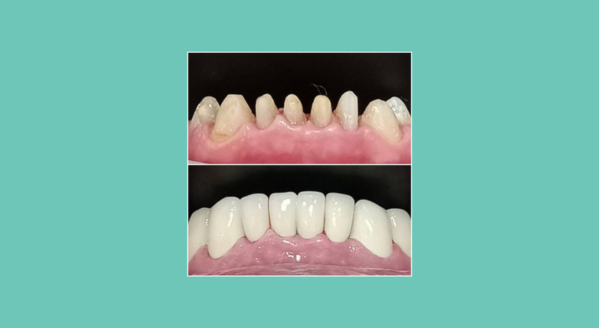 Paz Dental Clinic Paz Dental Clinic – พาซ เดนทัล คลีนิค ทำฟัน พาราไดซ์ พาร์ค 9