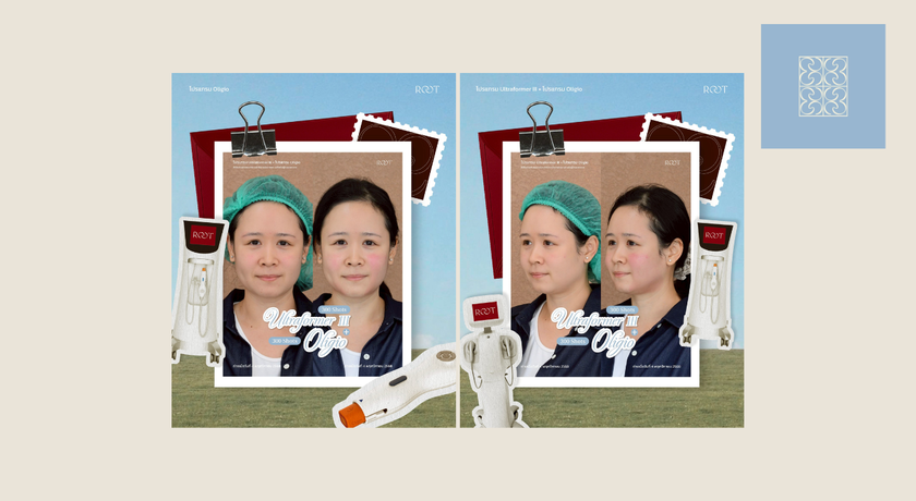 Root Clinic (CDC Zone L4 Floor 2) Root Clinic – รูท คลินิก ยกกระชับ ปรับรูปหน้า CDC เลียบด่วนรามอินทรา 9