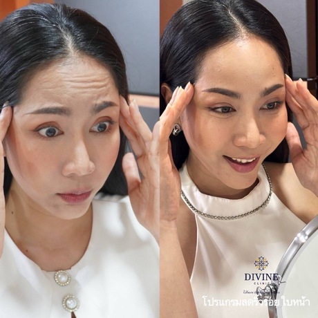 Divine Aesthetic Clinic Divine Aesthetic Clinic - ดีไวน์ คลินิก ปรับรูปหน้าและฟิลเลอร์ ย่านห้วยขวาง image_picker_7C0766A1-F596-4A70-A48D-6A3F005BA26C-16913-0000308E715214BF
