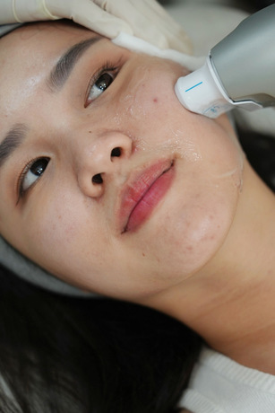 Divine Aesthetic Clinic Divine Aesthetic Clinic - ดีไวน์ คลินิก ปรับรูปหน้าและฟิลเลอร์ ย่านห้วยขวาง image_picker_BB76758A-41D0-45B5-9CE7-460AF02BCFEB-16913-0000308EF9F3FC61