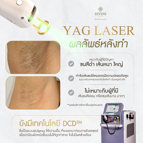 Divine Aesthetic Clinic Divine Aesthetic Clinic - ดีไวน์ คลินิก ปรับรูปหน้าและฟิลเลอร์ ย่านห้วยขวาง image_picker_BE8E3CDA-5577-467B-B4EB-C0962C8ADC65-16913-0000308F17A319A8