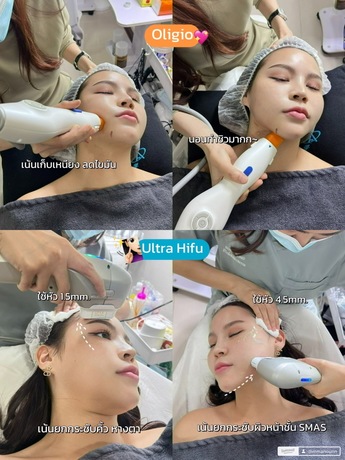 Divine Aesthetic Clinic Divine Aesthetic Clinic - ดีไวน์ คลินิก ปรับรูปหน้าและฟิลเลอร์ ย่านห้วยขวาง image_picker_82597751-7F94-4483-8FB6-9004AC2EFF4F-16913-0000308EFA127BAD